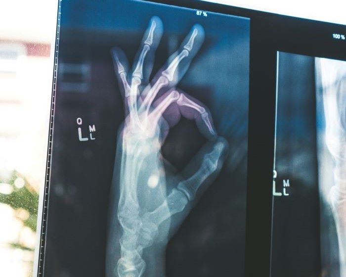 レントゲンの仕組み X線で骨が白く映る理由 イメージ図